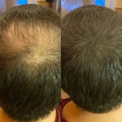 Cache-Cheveux Minéral — photo d'un client 5
