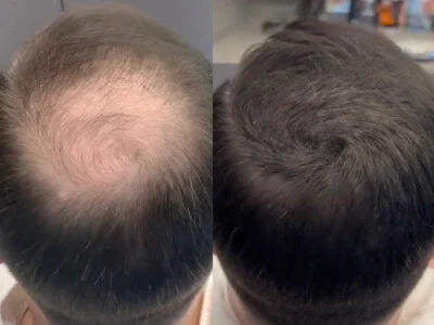 Cache-Cheveux Minéral — photo d'un client 6